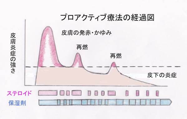 プロアクティブ療法の経過図