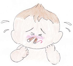子どもの花粉症(アレルギー性鼻炎)